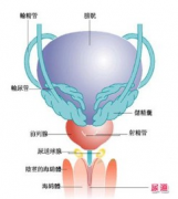 CRS弹道消融术,治疗尿道炎不