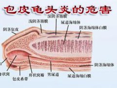 宜春龟头上有小疙瘩、脱